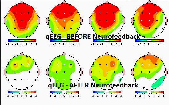 neurofeedback-results