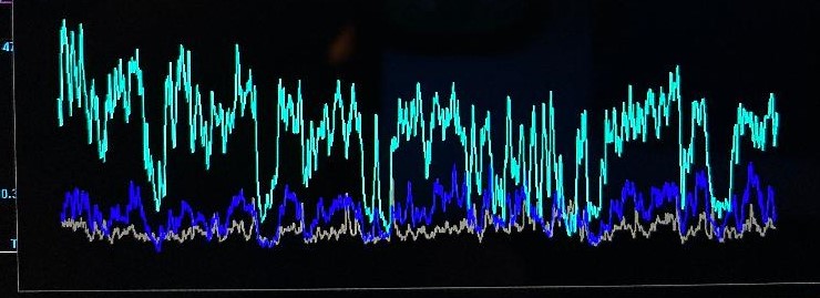 Does Sleep Affect the Heart? New Research Ties Insomnia to Cardiac Risk 6 brainwave graph